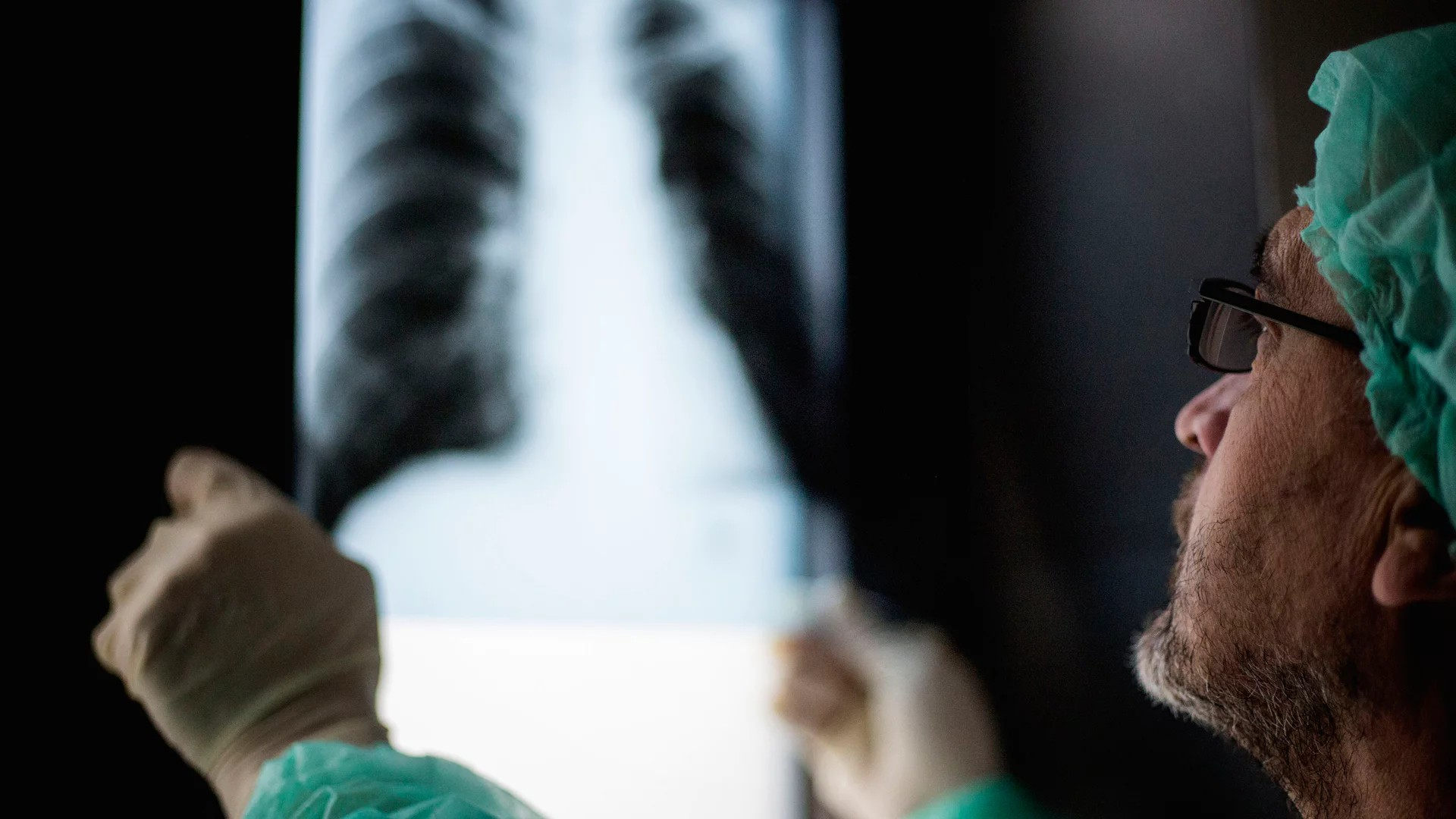 Arzt betrachtet Röntgenbild